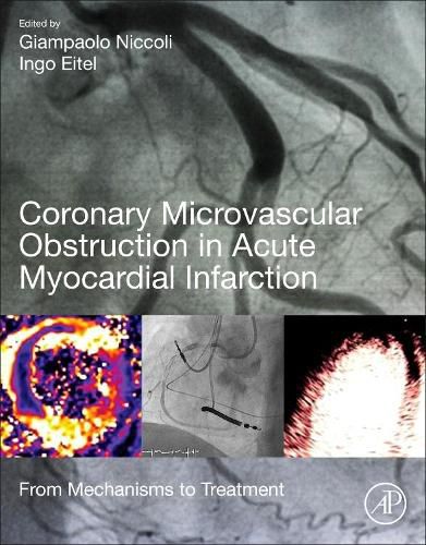 Cover image for Coronary Microvascular Obstruction in Acute Myocardial Infarction: From Mechanisms to Treatment