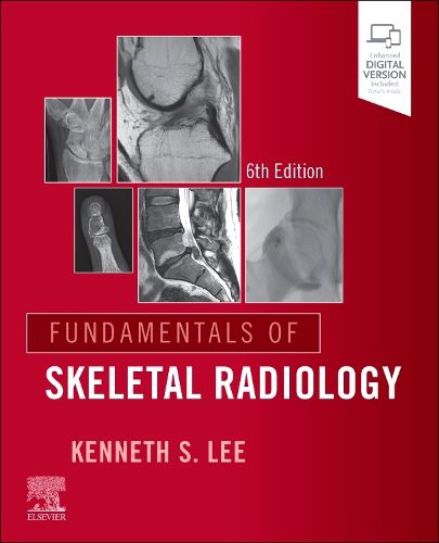 Cover image for Helms - Fundamentals of Skeletal Ra