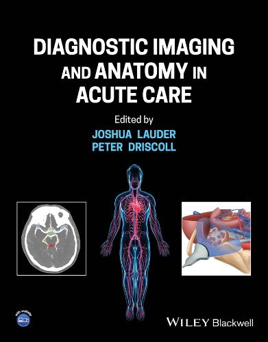 Cover image for Diagnostic Imaging and Anatomy in Acute Care