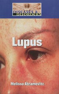 Cover image for Lupus