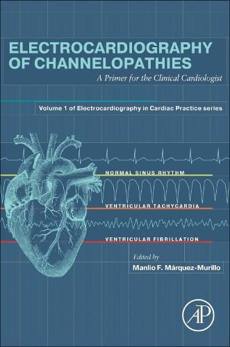 Cover image for Electrocardiography of Channelopathies