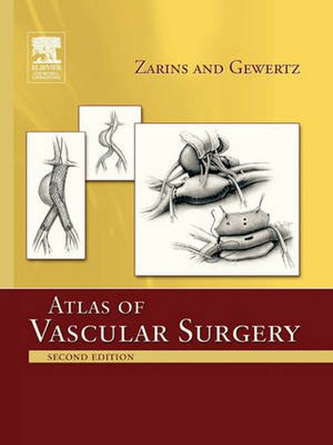 Cover image for Atlas Of Vascular Surgery - Paperback Edition