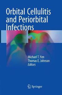 Cover image for Orbital Cellulitis and Periorbital Infections