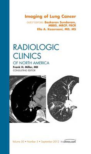 Cover image for Imaging of Lung Cancer, An Issue of Radiologic Clinics of North America