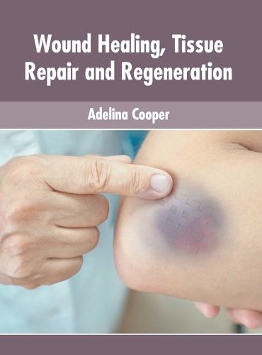 Cover image for Wound Healing, Tissue Repair and Regeneration