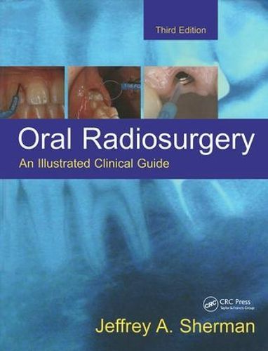 Cover image for Oral Radiosurgery: An Illustrated Clinical Guide