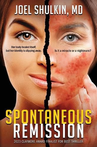 Cover image for Spontaneous Remission