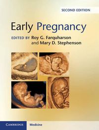 Cover image for Early Pregnancy