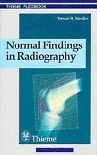 Cover image for Normal Findings in Radiography