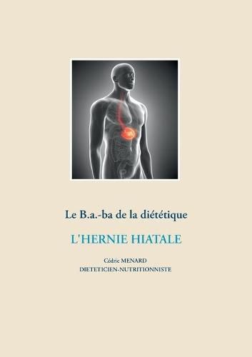 Le B.a.-ba dietetique de l'hernie hiatale