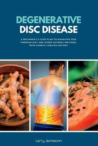 Cover image for Degenerative Disc Disease