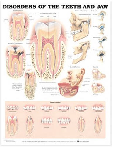 Cover image for Disorders of the Teeth and Jaw Anatomical Chart