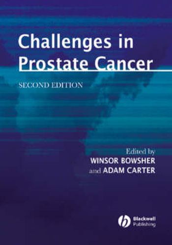 Cover image for Challenges in Prostate Cancer