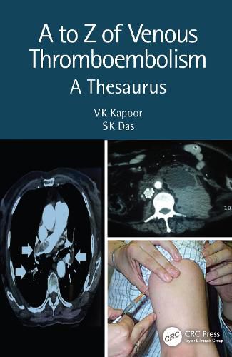 Cover image for A to Z of Venous Thromboembolism: A Thesaurus