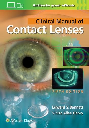 Cover image for Clinical Manual of Contact Lenses