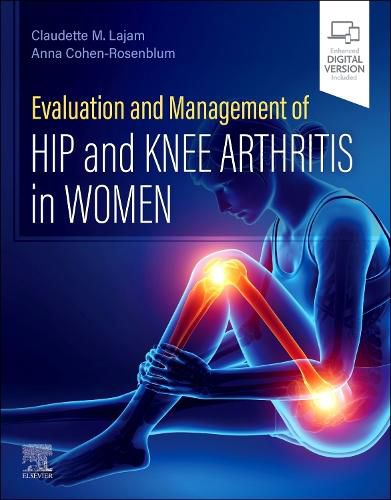 Cover image for Evaluation and Management of Hip and Knee Arthritis in Women