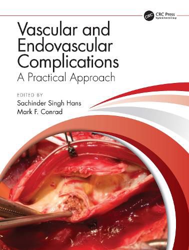 Cover image for Vascular and Endovascular Complications: A Practical Approach