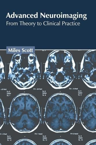 Cover image for Advanced Neuroimaging: From Theory to Clinical Practice