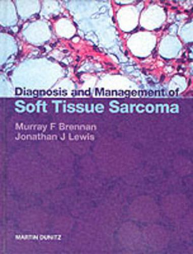 Cover image for Diagnosis and Management of Soft Tissue Sarcoma