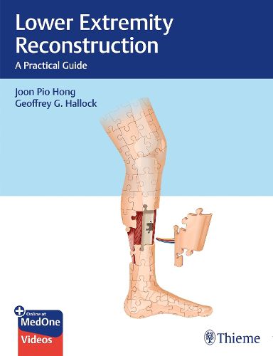 Cover image for Lower Extremity Reconstruction: A Practical Guide