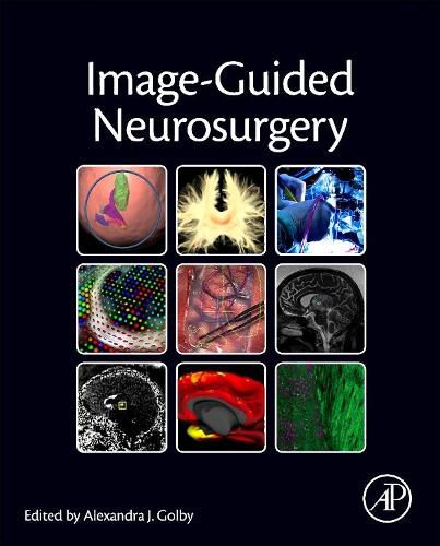 Cover image for Image-Guided Neurosurgery