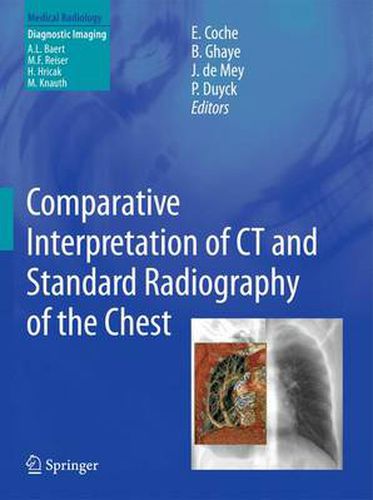 Cover image for Comparative Interpretation of CT and Standard Radiography of the Chest