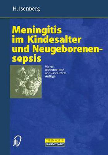 Cover image for Meningitis im Kindesalter und Neugeborenensepsis