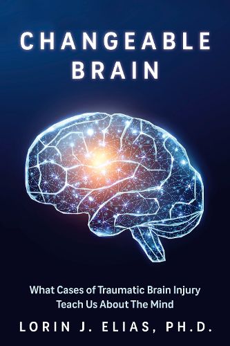 Cover image for Broken Brains