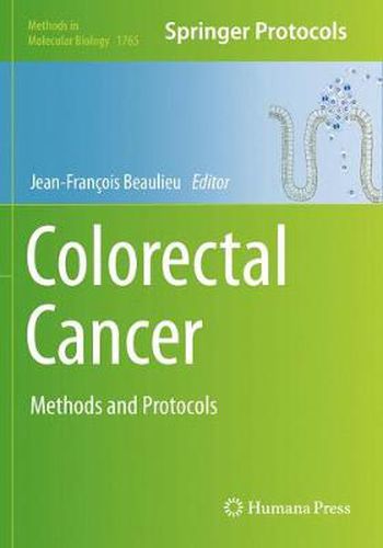 Cover image for Colorectal Cancer: Methods and Protocols