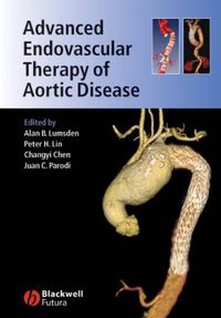 Cover image for Advanced Endovascular Therapy of Aortic Disease