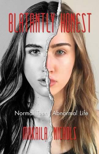 Cover image for Blatantly Honest: Normal Teen, Abnormal Life