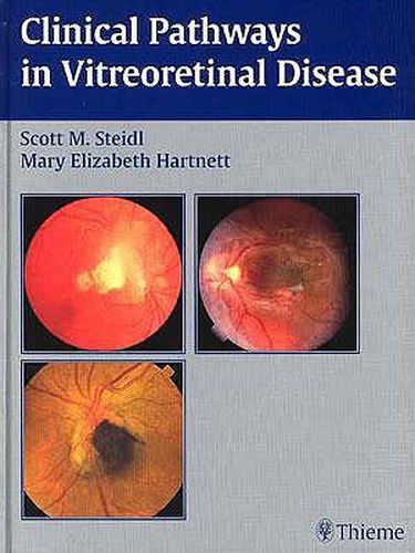 Cover image for Clinical Pathways In Vitreoretinal Disease