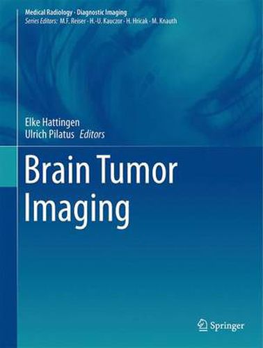 Cover image for Brain Tumor Imaging