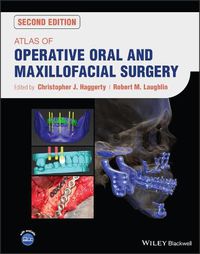 Cover image for Atlas of Operative Oral and Maxillofacial Surgery