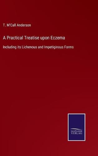 Cover image for A Practical Treatise upon Eczema: Including its Lichenous and Impetiginous Forms