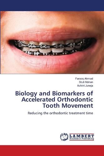 Cover image for Biology and Biomarkers of Accelerated Orthodontic Tooth Movement