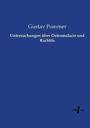 Cover image for Untersuchungen uber Osteomalacie und Rachitis