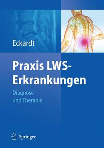 Cover image for Praxis LWS-Erkrankungen: Diagnose und Therapie