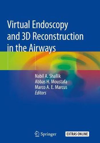 Cover image for Virtual Endoscopy and 3D Reconstruction in the Airways