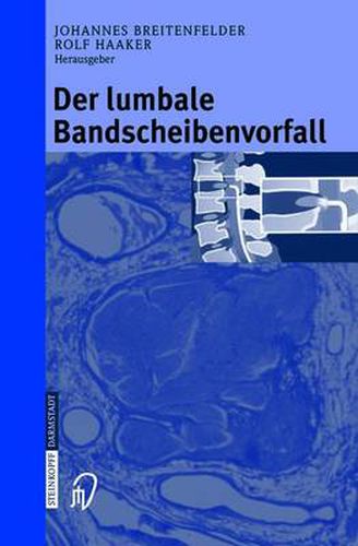 Cover image for Der Lumbale Bandscheibenvorfall