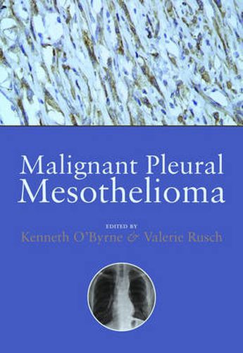 Cover image for Malignant Pleural Mesothelioma