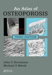 Cover image for An Atlas of Osteoporosis