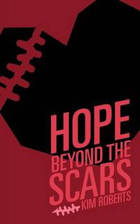 Cover image for Hope Beyond the Scars