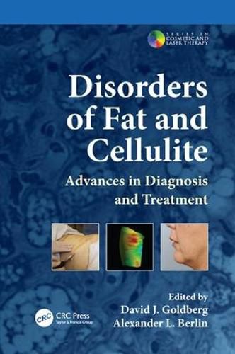 Disorders of Fat and Cellulite: Advances in Diagnosis and Treatment