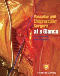 Cover image for Vascular and Endovascular Surgery at a Glance