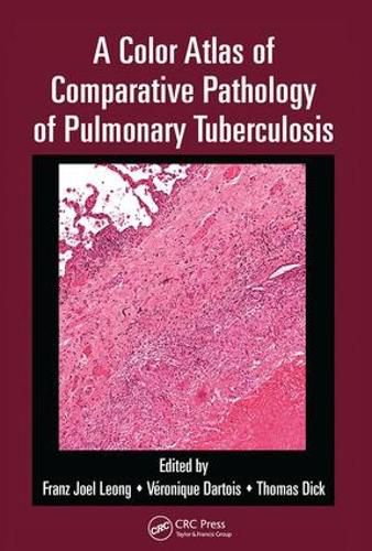 Cover image for A Color Atlas of Comparative Pathology of Pulmonary Tuberculosis