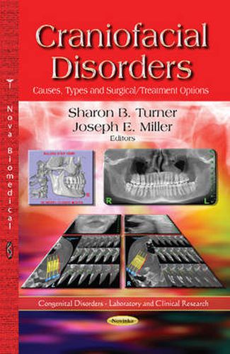 Craniofacial Disorders: Causes, Types & Surgical / Treatment Options