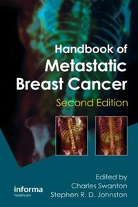 Cover image for Handbook of Metastatic Breast Cancer