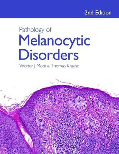 Cover image for Pathology of Melanocytic Disorders 2ed