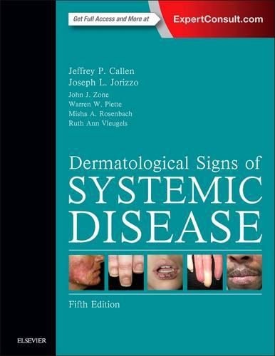 Cover image for Dermatological Signs of Systemic Disease